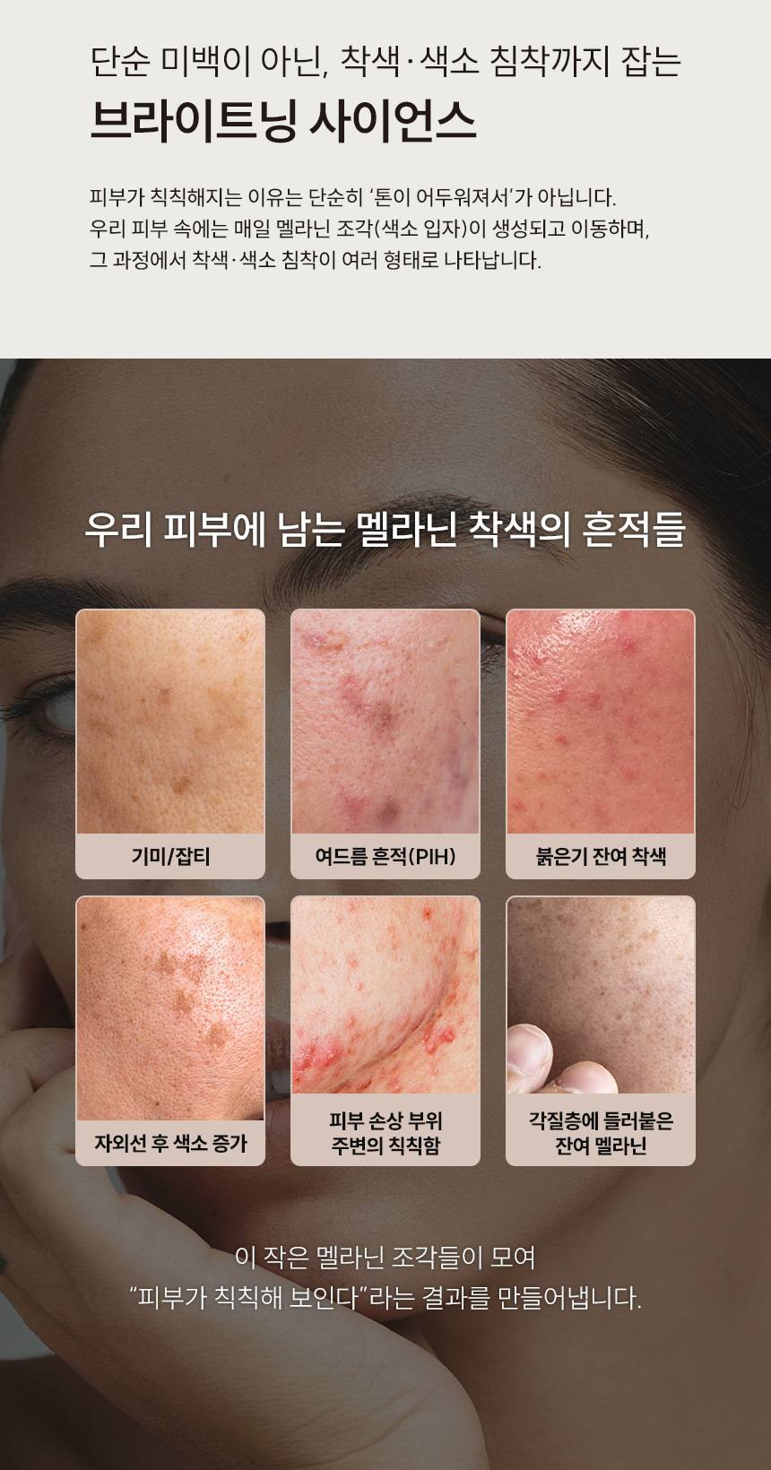 파머시안 멜라리스 100000 크림 30g 상세 3